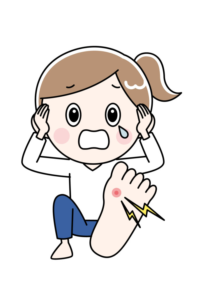 足裏にできたタコと魚の目の位置を示すイラスト