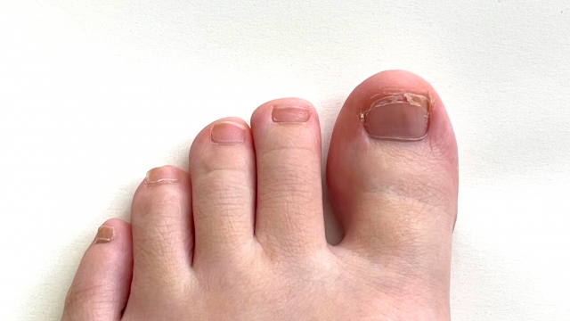 清潔な足のつま先部分。爪の健康状態を確認できるように撮影された写真。
